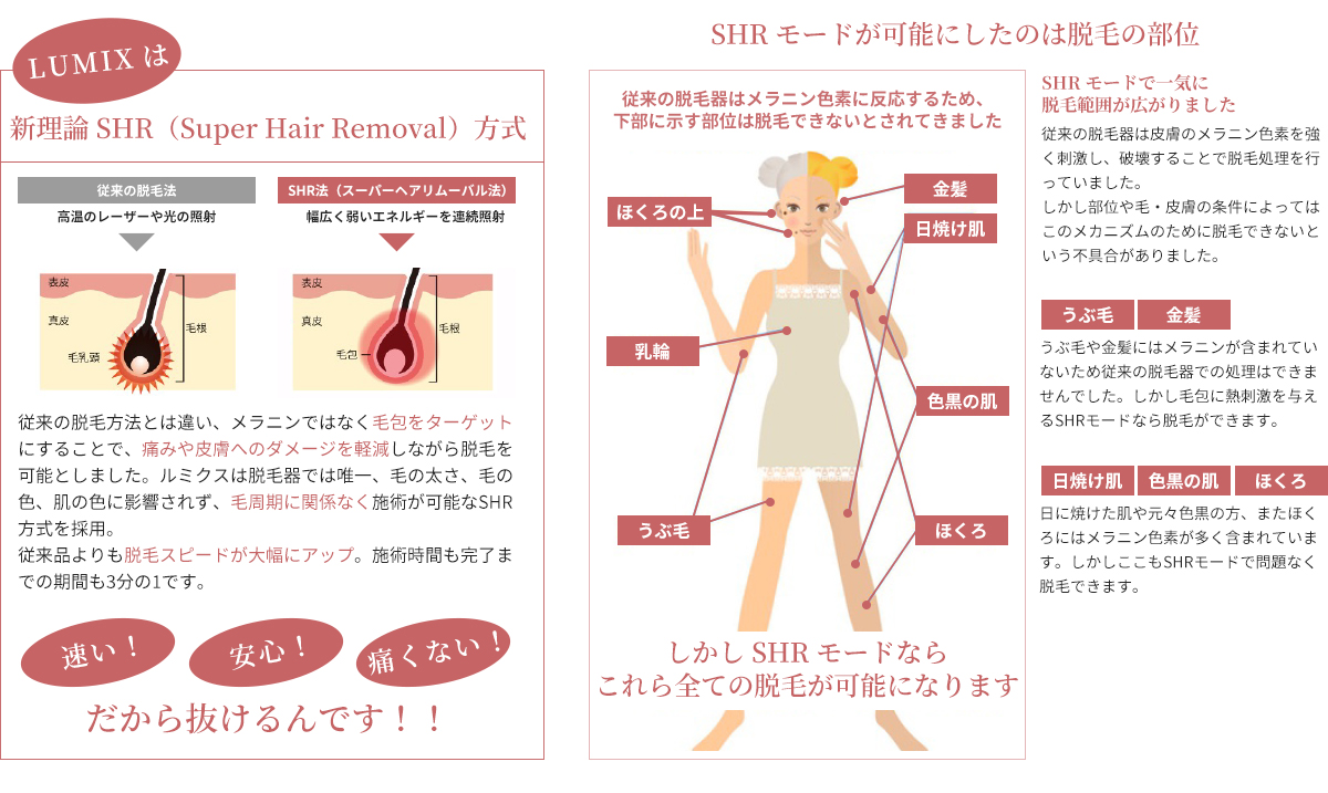 当サロンは脱毛にSHR方式を採用しています